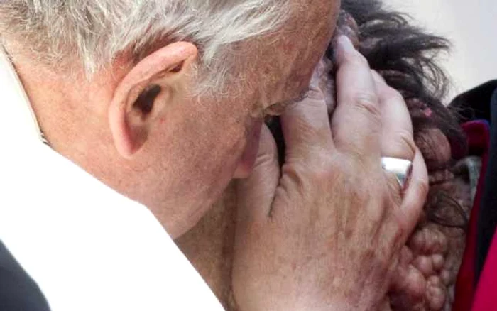 Papa Francisc, îmbrăţişând omul bolnav
