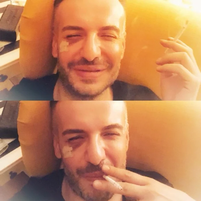 Răzvan Ciobanu a fost lovit de fostul lui iubit