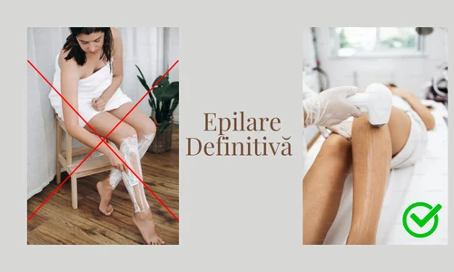 500 cliente mul umite dupa epilare definitiva jpg