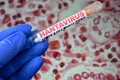 hantavirus getty jpeg