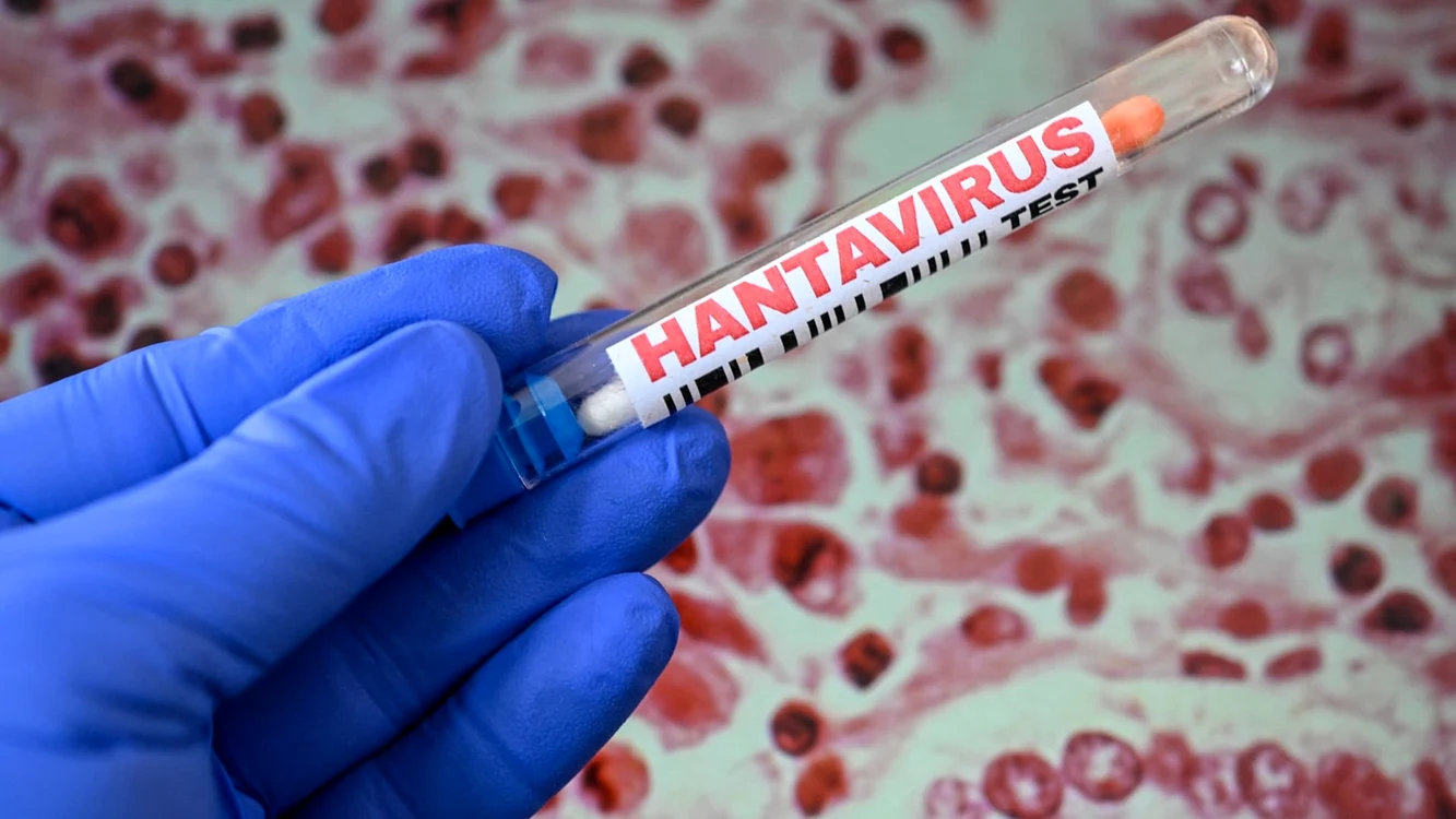 Un pacient din Arad ar fi confirmat cu hantavirus / foto: Getty Images