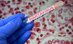 hantavirus getty jpeg