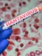 hantavirus getty jpeg