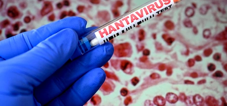 hantavirus getty jpeg