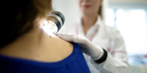 Centru multidisciplinar integrat pentru tratarea melanomului png
