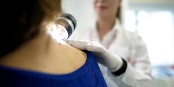 Centru multidisciplinar integrat pentru tratarea melanomului png