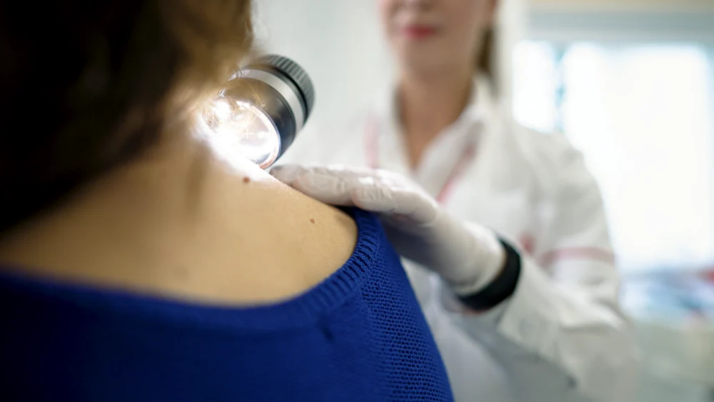 În București a fost deschis un centru dedicat diagnosticării și tratării melanomului