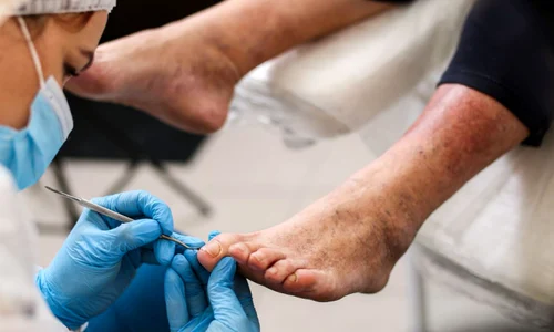 probleme podologice la varstnici jpg