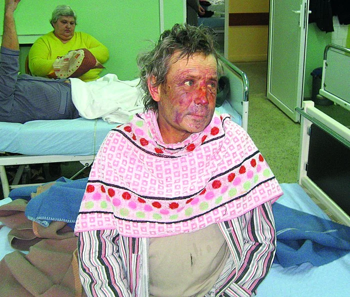 
    Iosif Colar va sta câteva  zile pe patul spitalului  