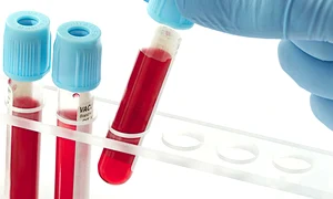 blood type test jpeg