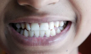 pexels towfiqu barbhuiya 3440682 12474261 jpg