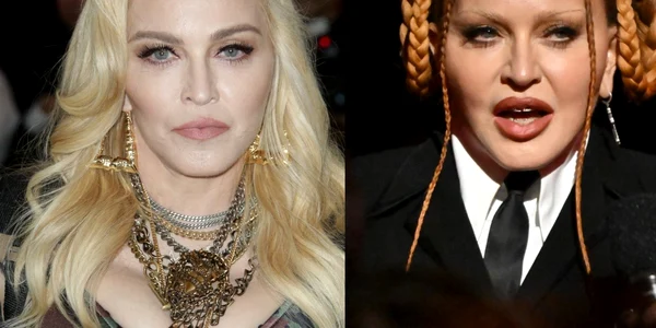 Madonna Foto Profimediapng jpg