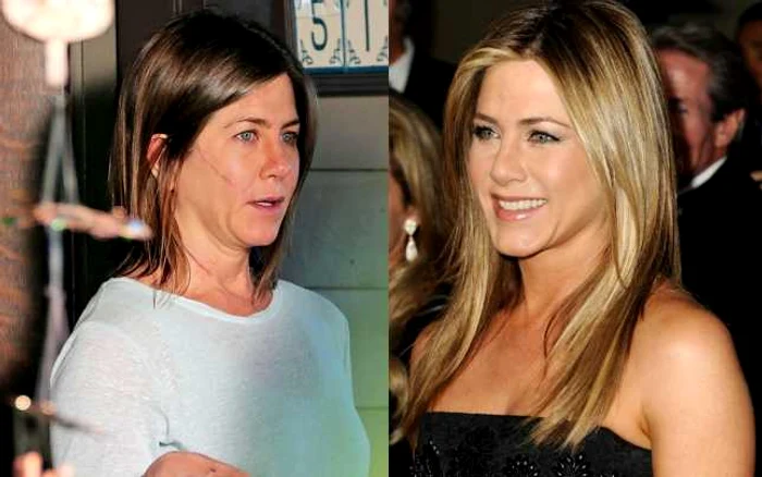 Jennifer Aniston s-a transformat total pentru a interpreta o femeie depresivă în drama „Cake“ (stânga) FOTO Getty Images