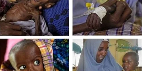 Un băiețel din Somalia a reuşit să supravieţuiască foametei 