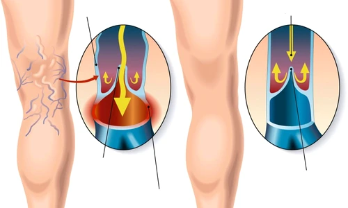 1 75123 original jpg jpeg