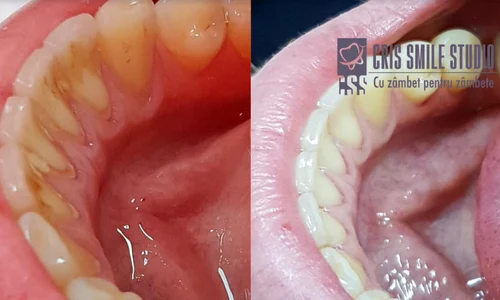 1 screen shot 2019 10 15 at 11 18 52 png png