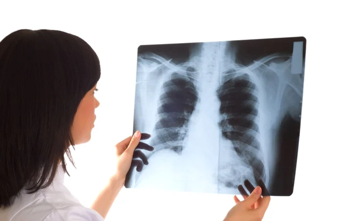 Pentru că radiografia pulmonară este rapidă şi uşoară, este foarte utilă şi în cazuri de urgenţă.