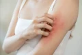 dermatolog jpg