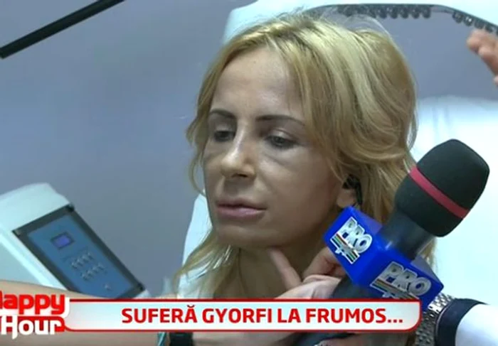 Daniela Gyorfi este încântat de felul în care arată nasul ei după operaţie. (captură Pro TV)