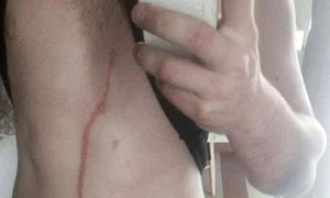 Dylan Thomas s a întors din Bali cu un parazit în abdomen jpeg