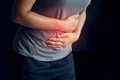 ulcer perforat jpg
