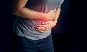 ulcer perforat jpg