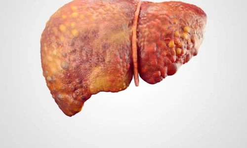 ficat gras regim jpeg