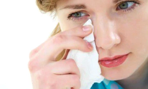 1 conjunctivita jpg jpeg