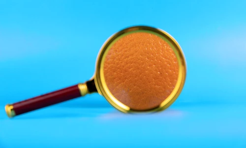 De ce sunt femeile mai predispuse la celulita  Sursa foto shutterstock 1910353735 jpg