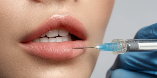 marire buze cu acid hialuronic skin medspa jpeg