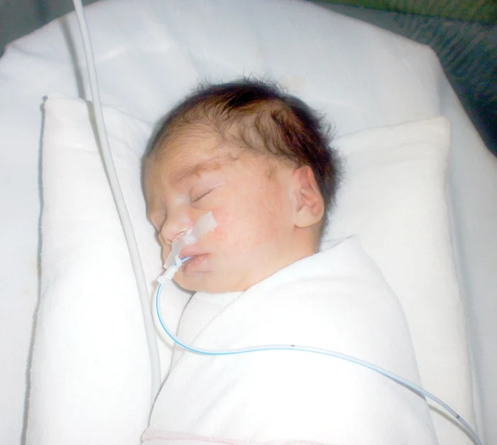 
    Lorena va trebui din nou operată  peste 6 luni, apoi la vârsta de 6 ani  