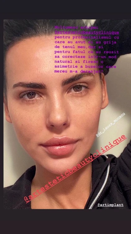 1 lavinia pirva interventii la fata jpg jpeg