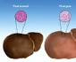 Alimente pentru ficat gras  Ce mănânci dacă ai această afecţiune jpeg