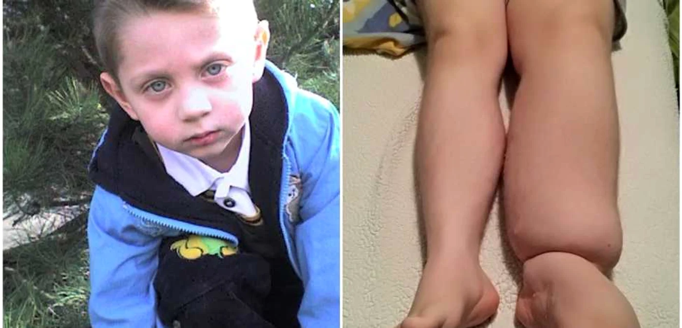 Gabriel se chinuie cu o boală rară care în acest moment nu are vindecare