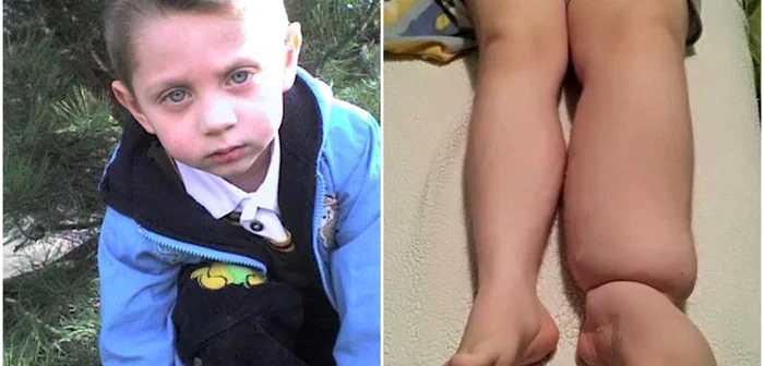 Gabriel se chinuie cu o boală rară care în acest moment nu are vindecare
