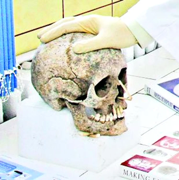 Craniul de sex feminin este  mai mic decât cel masculin,  iar fruntea are altă formă