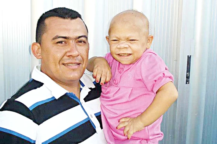 Nu merge şi nu vorbeşte şi trebuie îngrijită ca un nou-născut