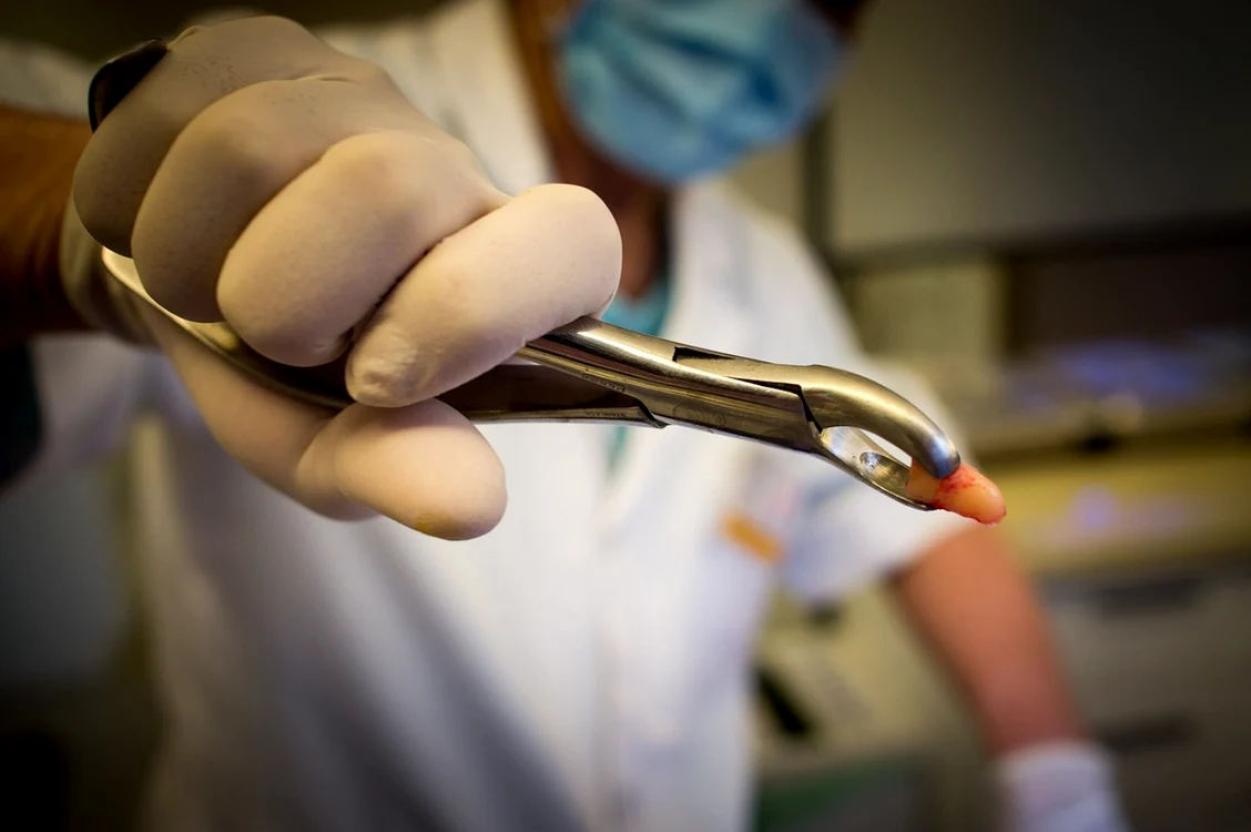 Medicul a extras mii de dinți sănătoși FOTO pixabay.com
