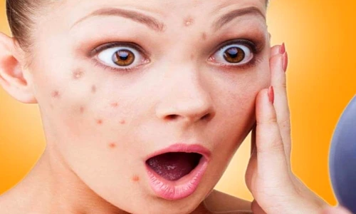 1 81046 original jpg jpeg