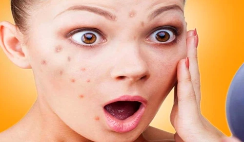 1 81046 original jpg jpeg