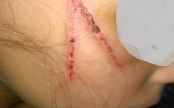 Un vecin a chemat asistența socială. Se speriase de vânătăile pe care le observase pe corpul celor trei fete, de 6, 8 și 11 ani