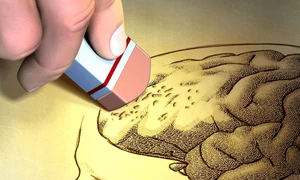 diagnosticat cu Alzheimer Foto Shutterstock png