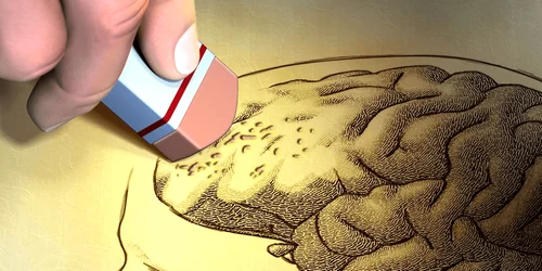 diagnosticat cu Alzheimer Foto   Shutterstock png