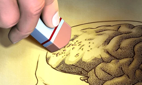 diagnosticat cu Alzheimer Foto   Shutterstock png