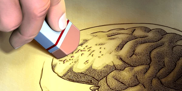 diagnosticat cu Alzheimer Foto   Shutterstock png