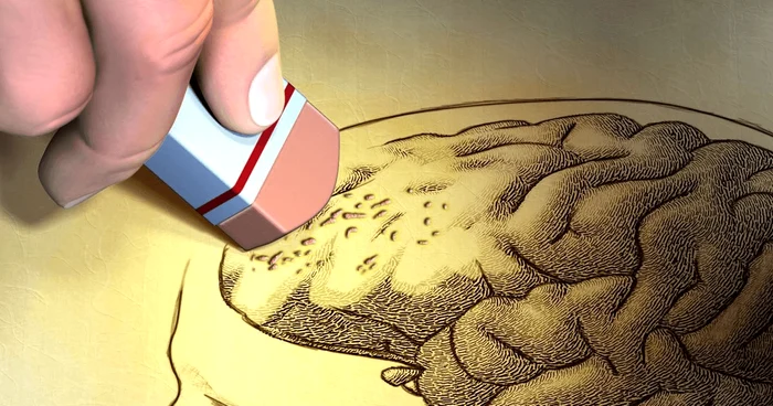 alzheimer