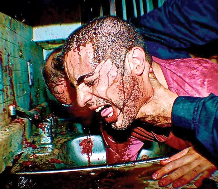 Experimentează cum e să fii strangulat