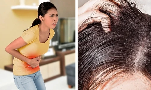 1 motivele incredibile pentru care apare matreata sigur nu stiai asa ceva lifb jpg jpeg