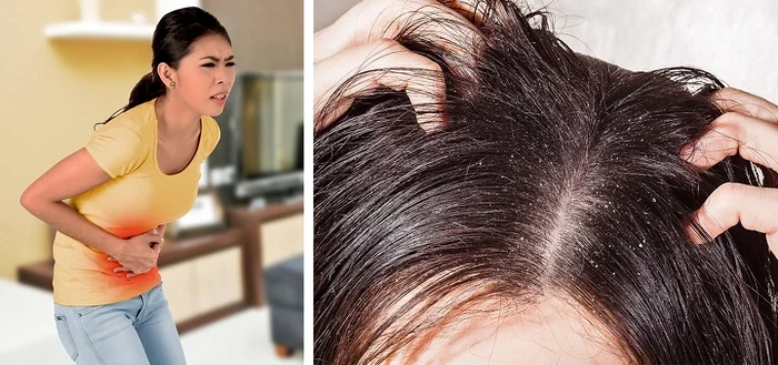 1 motivele incredibile pentru care apare matreata sigur nu stiai asa ceva lifb jpg jpeg