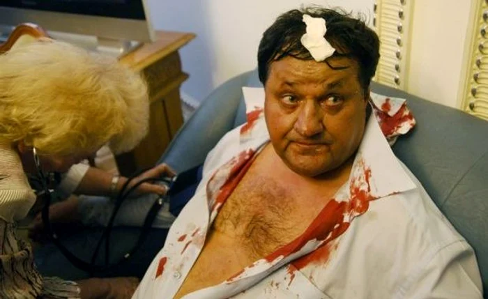 Deputatul Mykola Petruk primind primul ajutor după ce a fost lovit de colegii lui din Parlament. (Foto: AP)